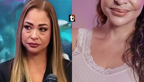 Melanie Martínez presume su nuevo rostro tras someterse a cirugía estética