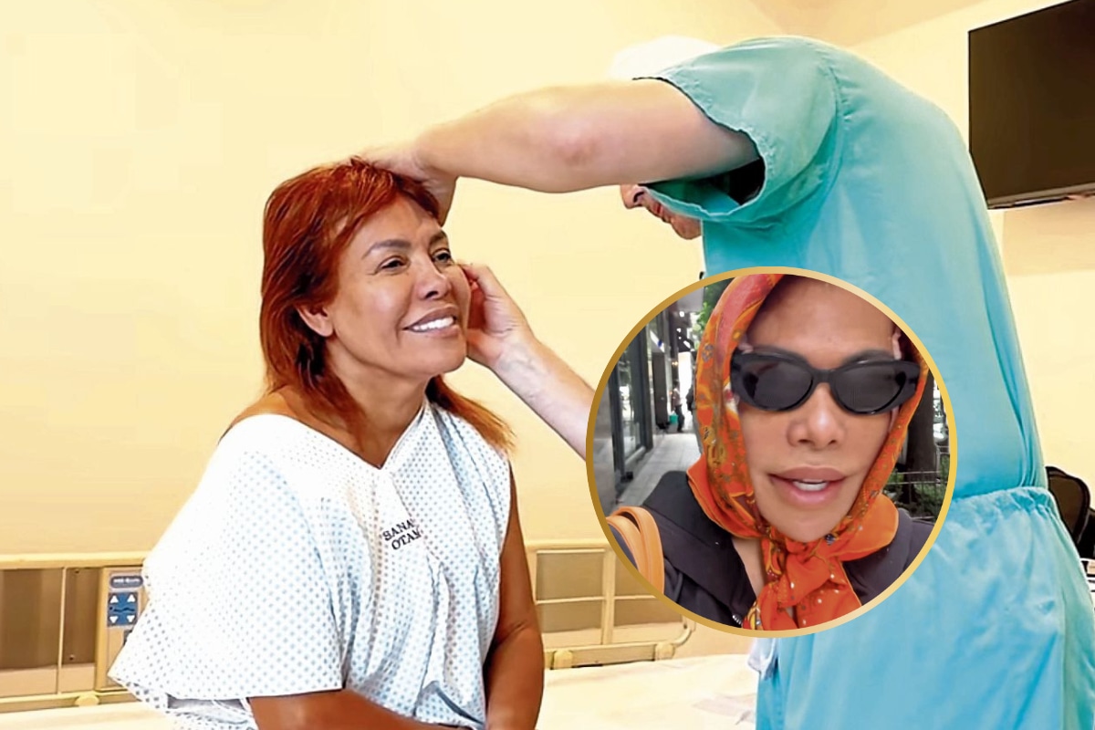 Trolean a Magaly Medina por cirugía en la cara