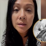 Salió de sala de operaciones: “Fue complicado"