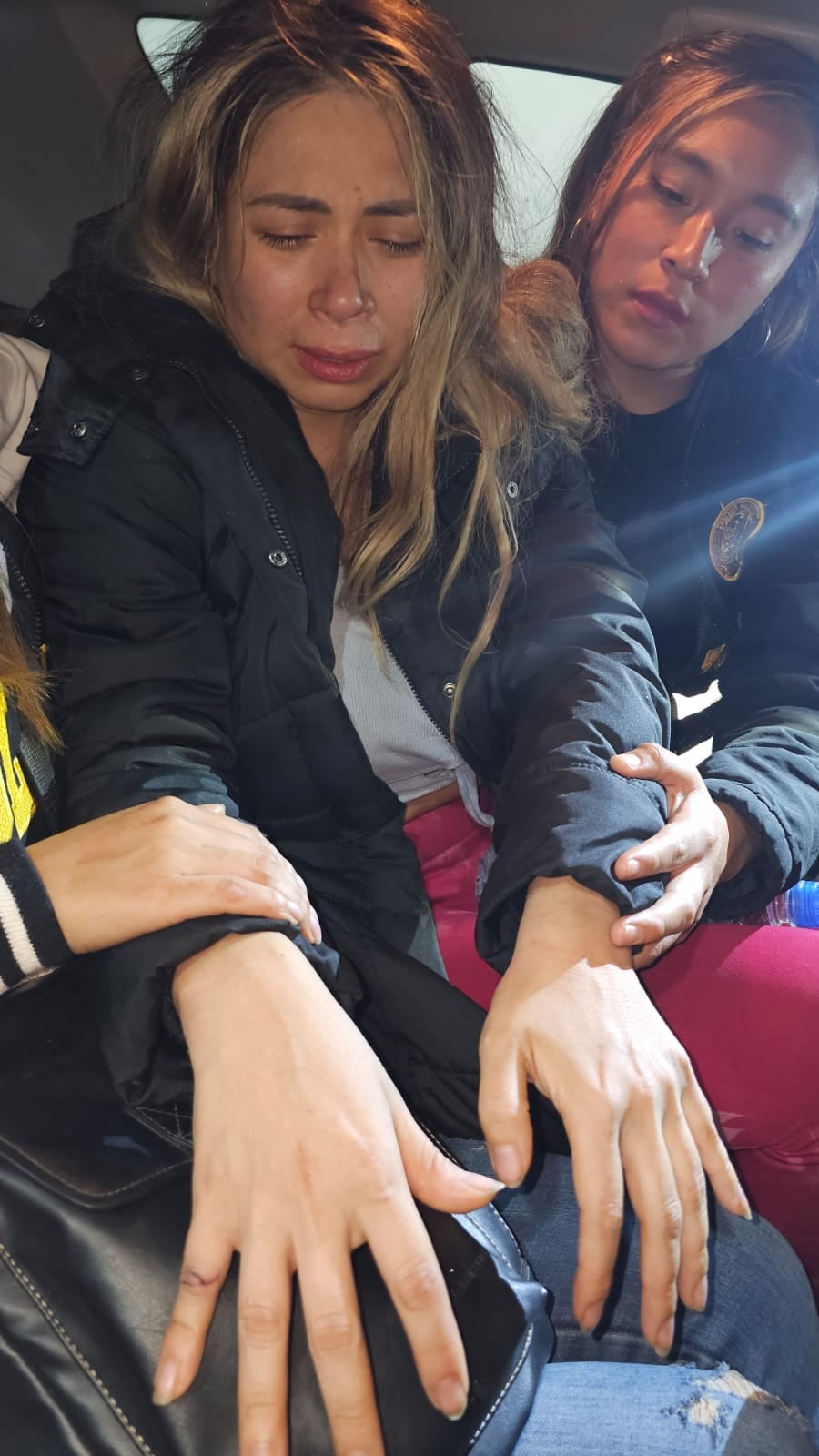 Jackeline Salazar recibió un corte en el dedo, aunque finalmente no se lo mutilaron.