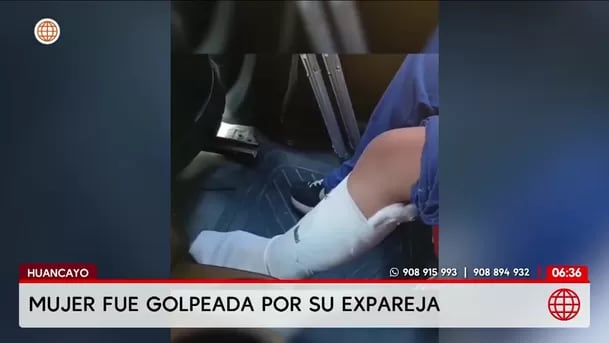 Hombre golpea a su exenamorada y a una joven en Huancayo. Foto: América Noticias