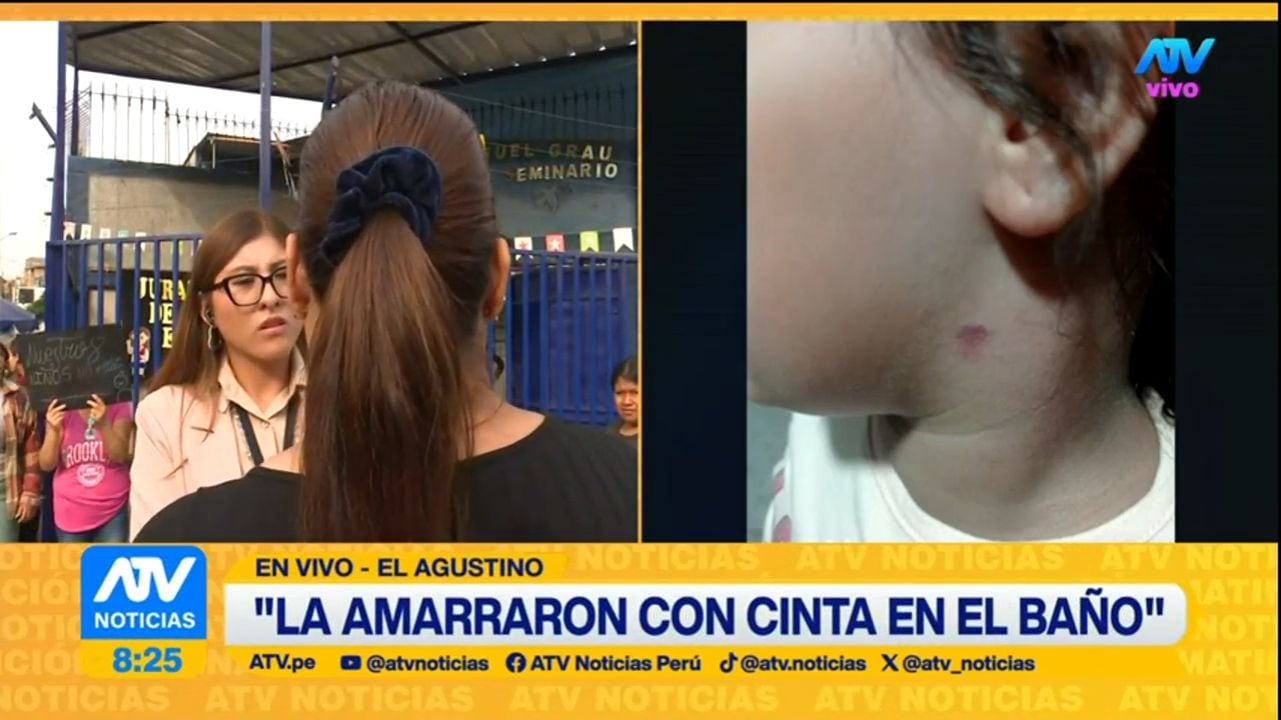 Una de las niñas terminó con un chupetón en el cuello. Foto: ATV