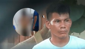 Intento de feminicidio en Ucayali: Hombre roció gasolina a su pareja y le prendió fuego