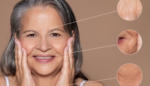 Cirugía estética y adultos mayores: ¿Por qué existe tanto prejuicio sobre este tema?, ¿Qué cuidados deberían tener?