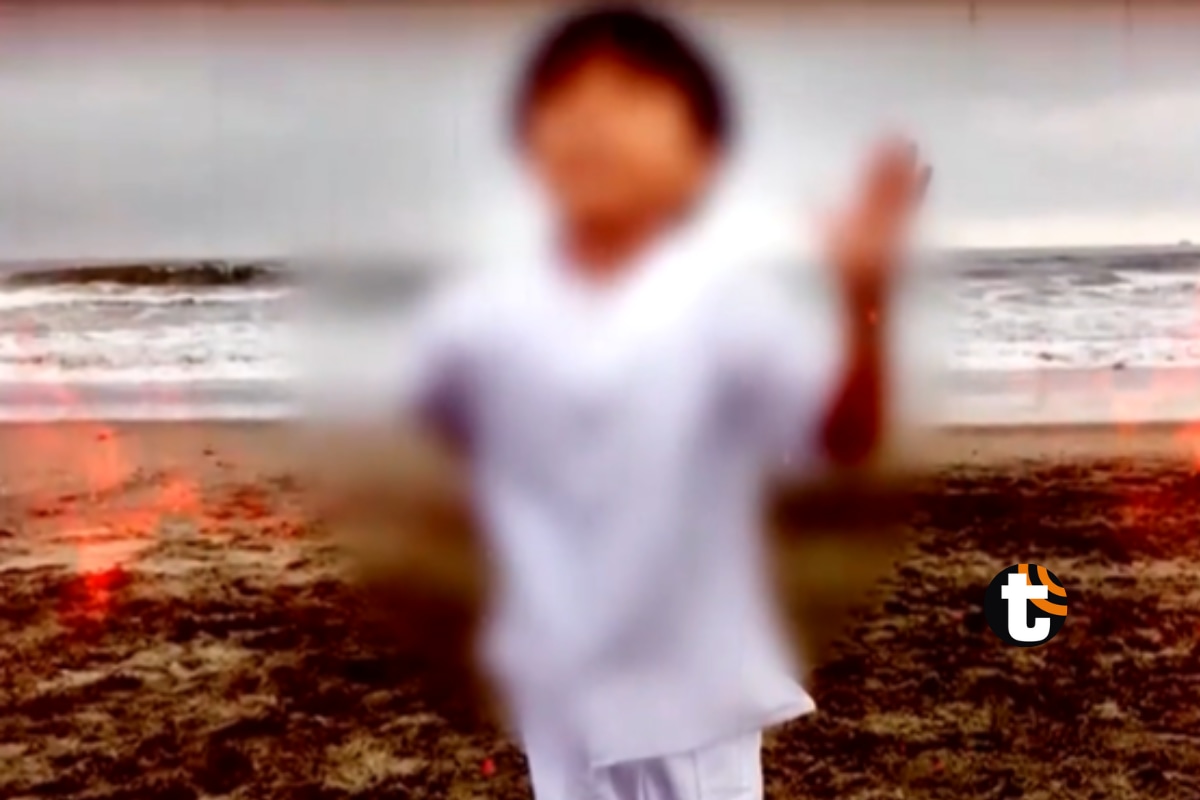 Menor quemado en playa Arica