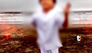 Niño quemado en sesión de fotos es operado por segunda vez: Este es su estado