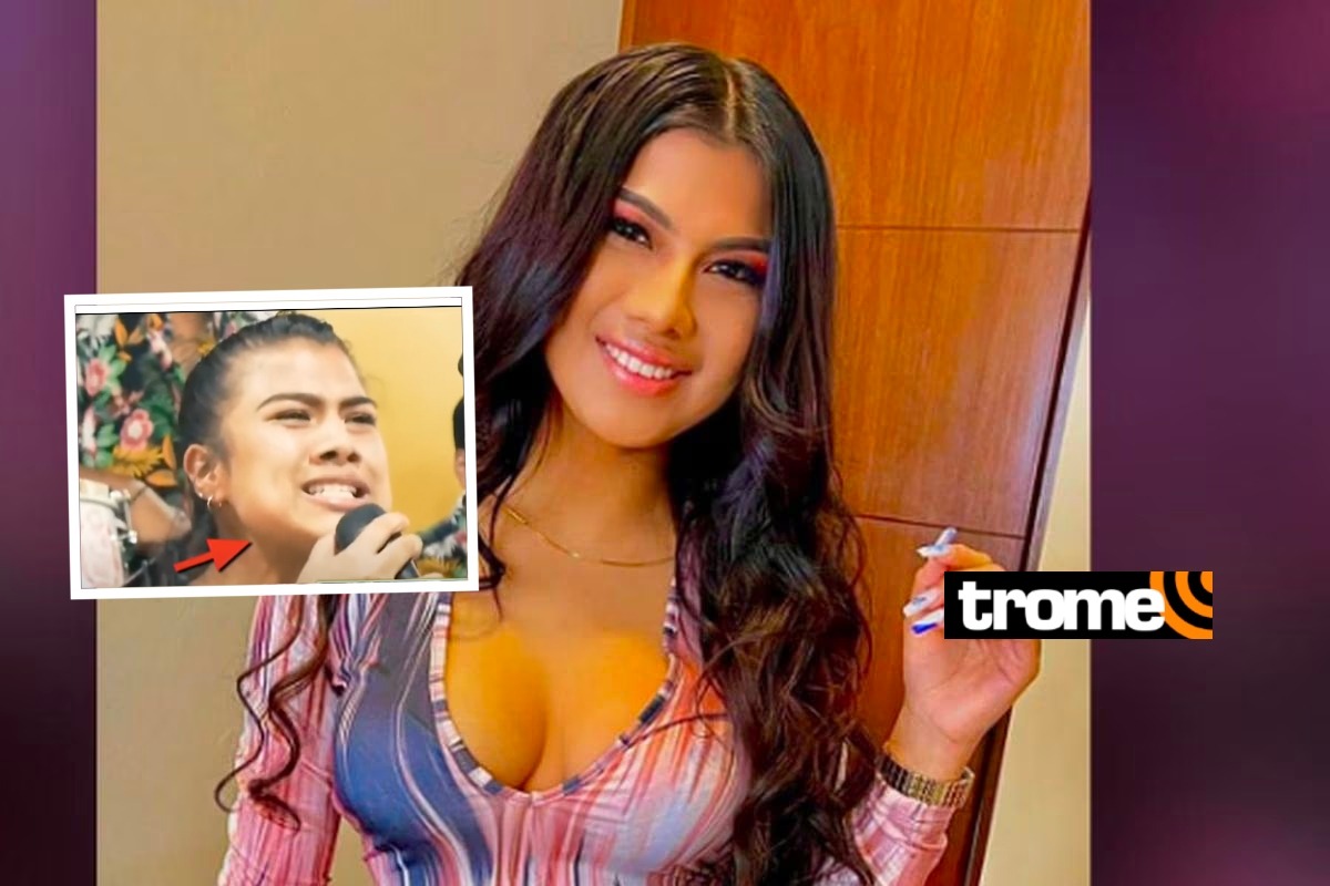 Brunella Torpoco: Cuánto gastó en cirugías