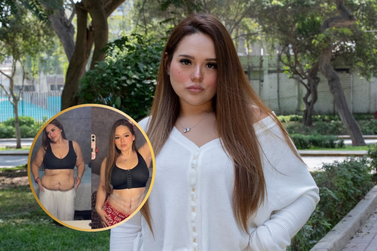 Susan Pietro se sometió a tres cirugías reconstructivas tras bajar de peso: Lipoabdominoplastia, braquiplastía y mastopexia