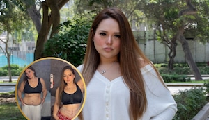 Susan Pietro se sometió a tres cirugías reconstructivas tras bajar de peso: Lipoabdominoplastia, braquiplastía y mastopexia
