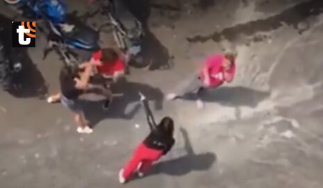 ¡Brutal pelea en Surquillo! Mujer termina con más de 60 puntos en el rostro y el pecho tras violenta gres...