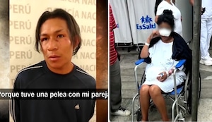 Callao: hombre arranca parte de nariz de su expareja con un mordisco