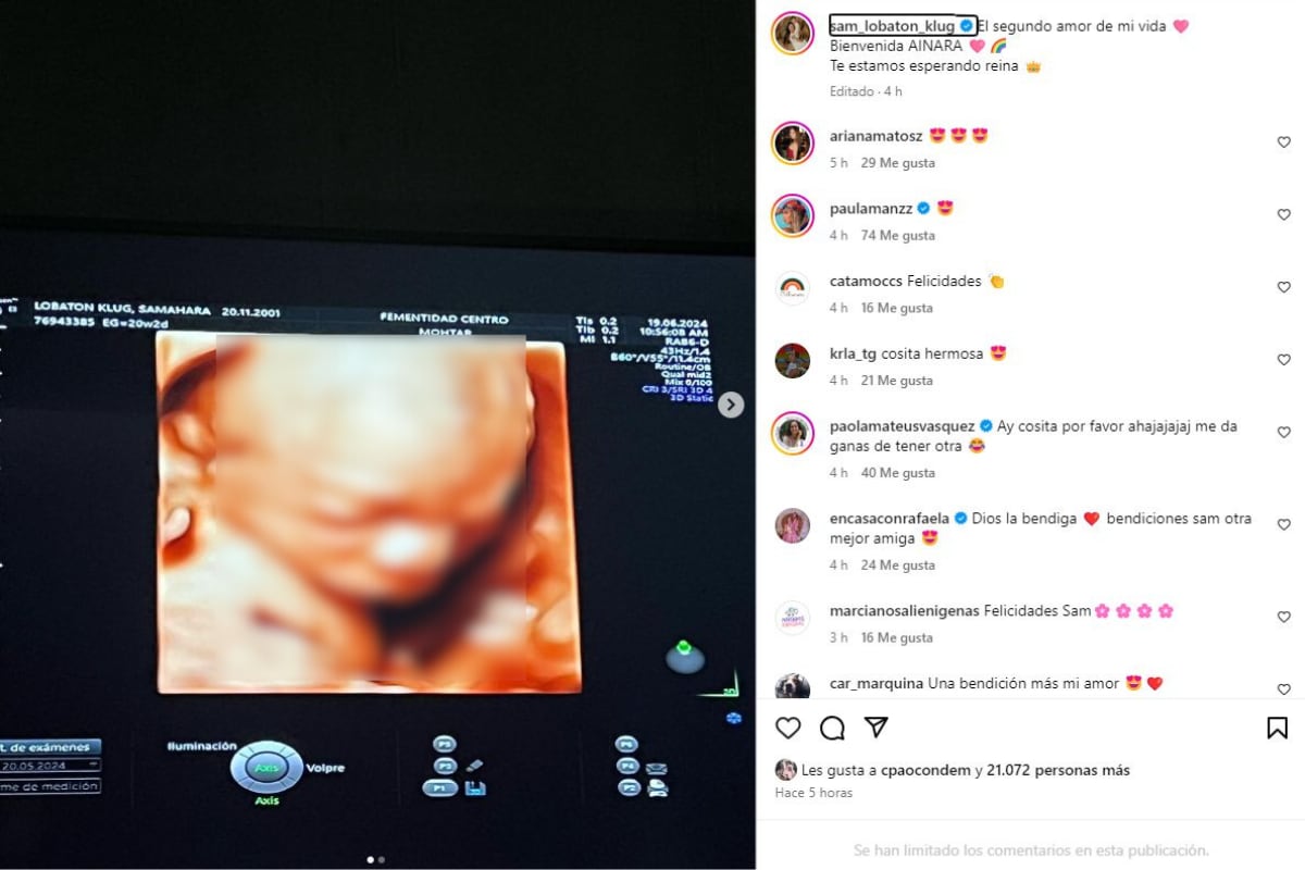 Ecografía de Samahara Lobatón