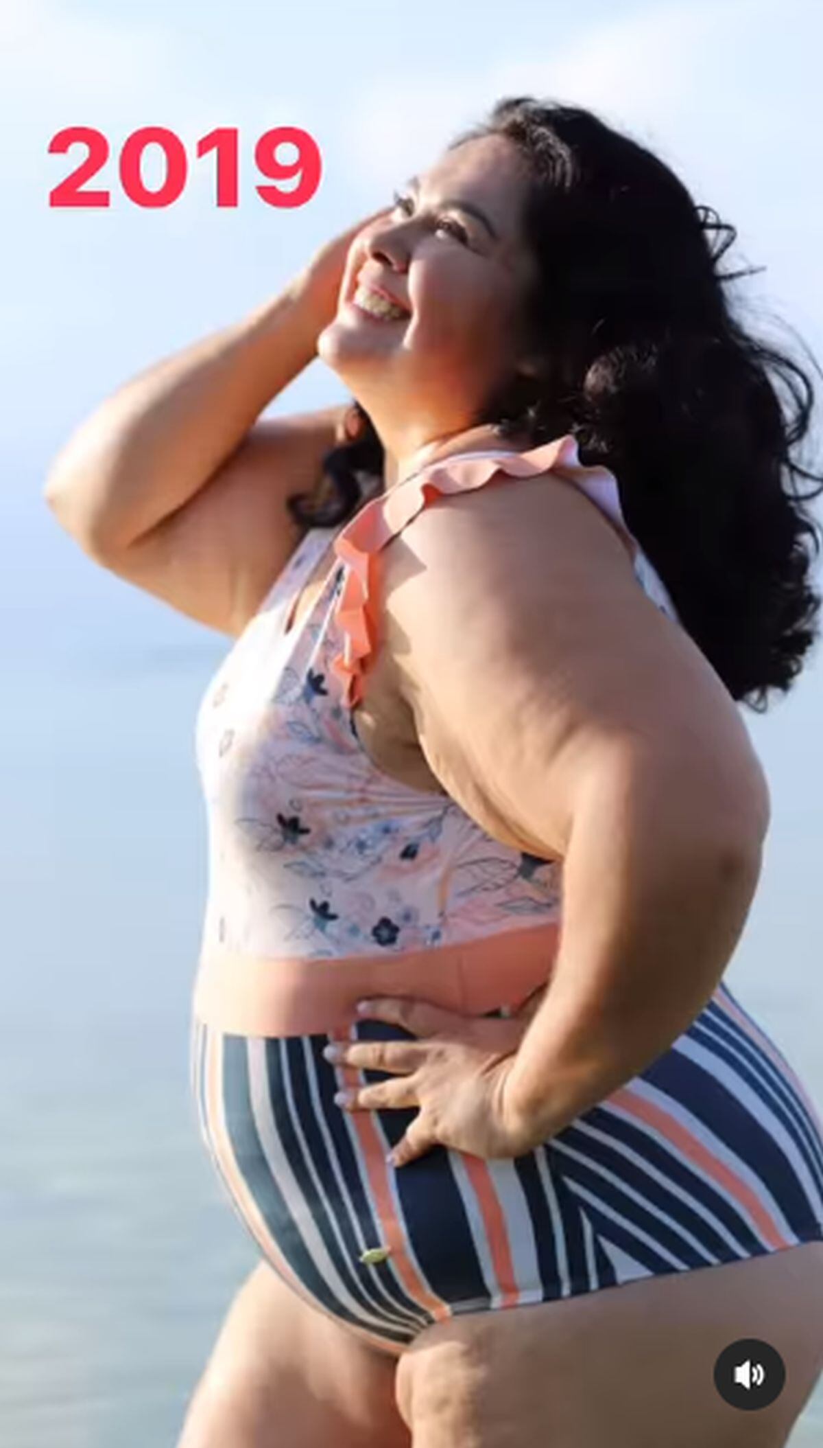 Imágenes de cómo lucía la actriz antes de la intervención quirúrgica (Foto: Gisella Aboumrad / Instagram)