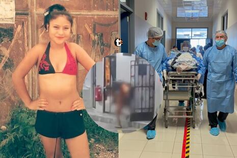 ¡Horror en Tingo María! Joven llegó envuelta en llamas a un grifo y ahora lucha por su vida en Lima