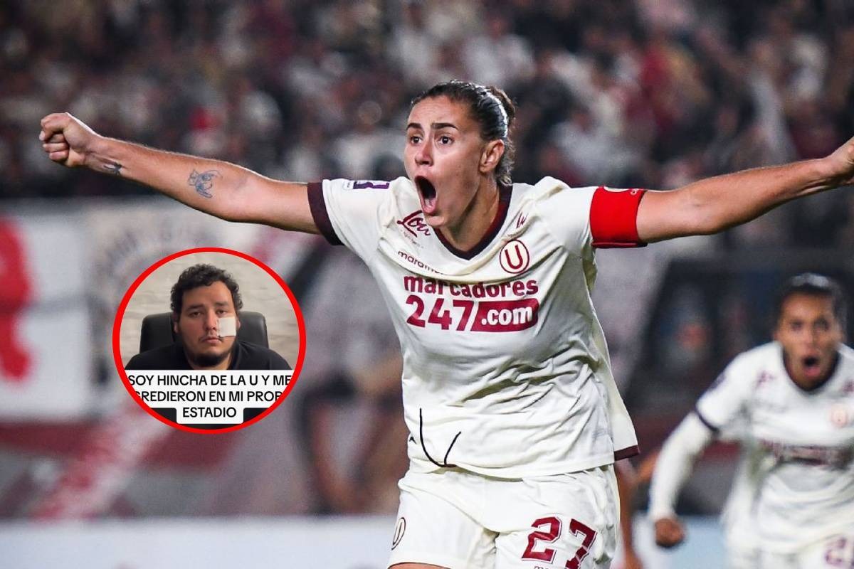 Hincha de la U reveló que fue agredido en el Monumental. Foto: Difusión