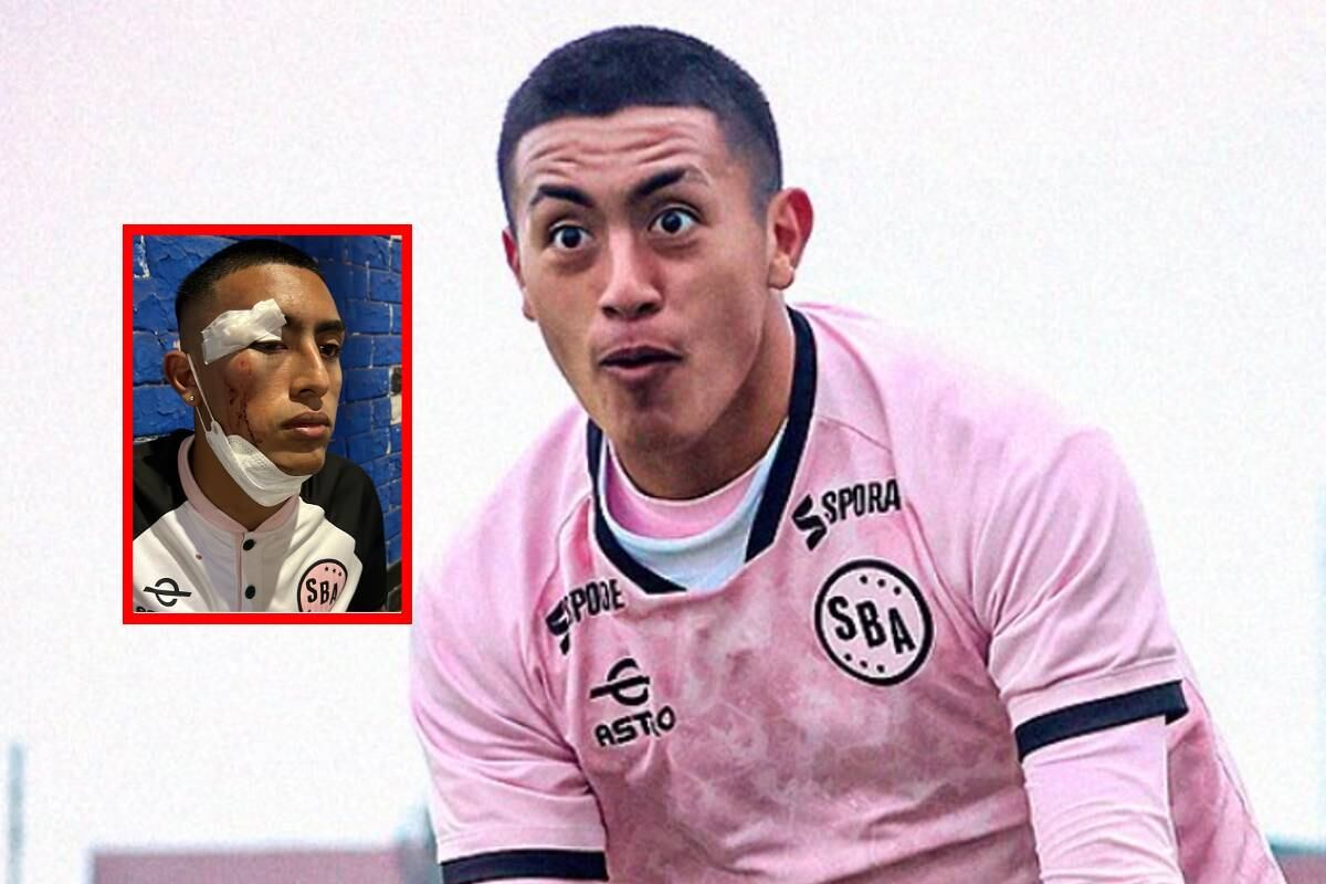 Fabrizio Roca fue agredido por barristas tras el último partido del Sport Boys. Foto: Difusión