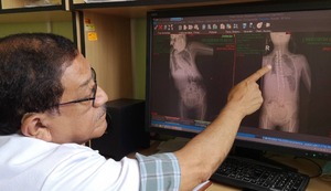 INSN: ¡Cuidado! No confundas la mala postura de tu hijo, podría ser una deformación de la columna vertebral