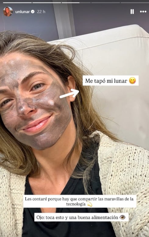 Stephanie Cayo explica cómo funciona el procedimiento facial.