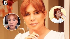 Magaly confiesa que perdió sensibilidad en oreja tras cirugía en Argentina: “No siento mucho esta parte”