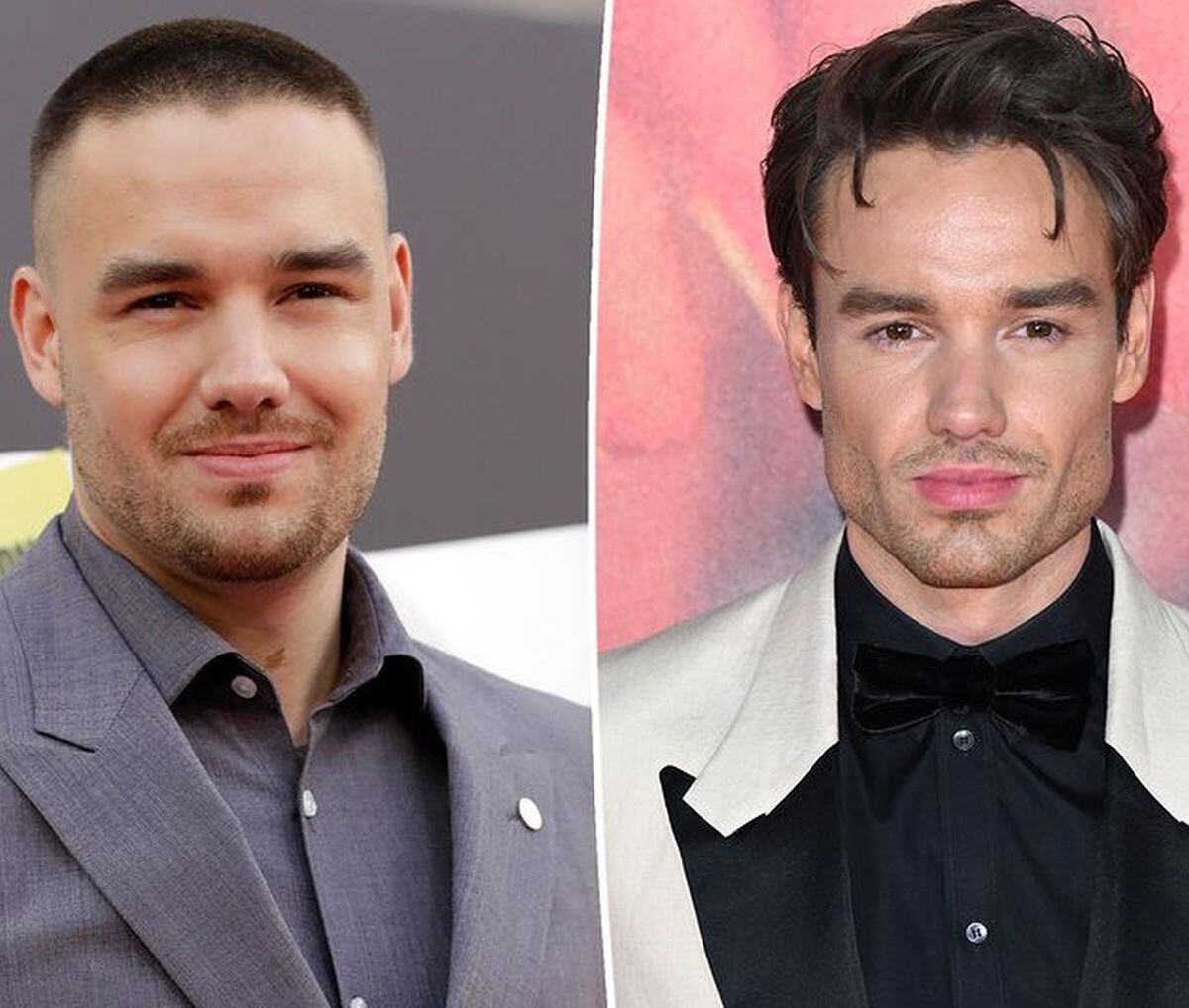 El antes y después de Liam Payne (Foto: farandulanews / Instagram)
