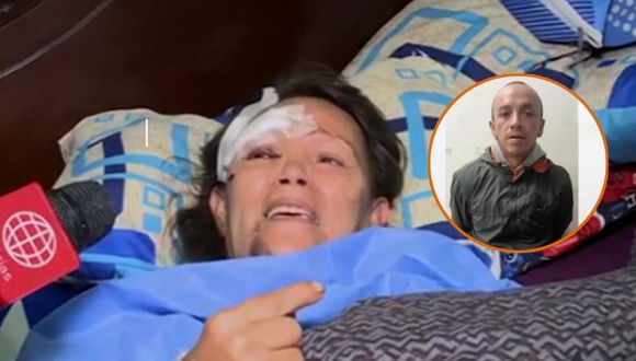 Ventanilla: Hombre atacó a su madre con un balón de gas