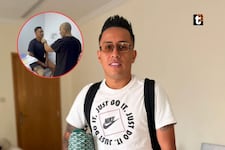 Cueva deja en shock al someterse a ‘retoquito’ en el rostro y revela el impensado motivo: “Me veía al espejo”