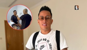 Cueva deja en shock al someterse a ‘retoquito’ en el rostro y revela el impensado motivo: “Me veía al espejo”