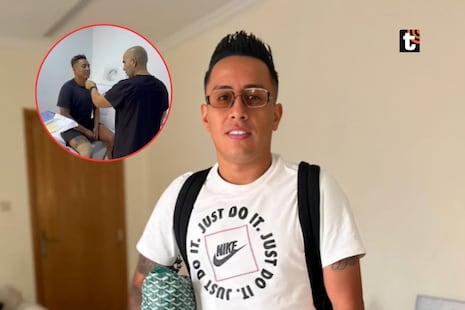 Cueva deja en shock al someterse a ‘retoquito’ en el rostro y revela el impensado motivo: “Me veía al esp...