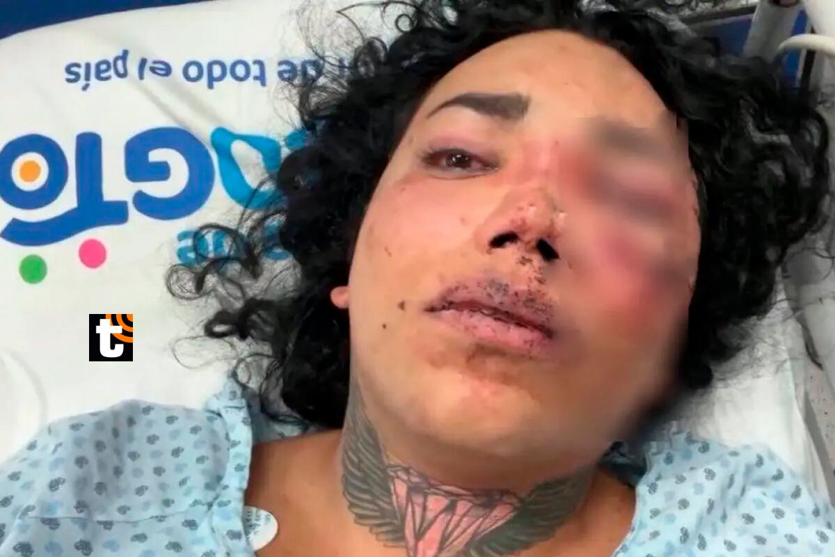 Paolita Suárez, de 'Las Perdidas', hospitalizada tras agresión de su novio