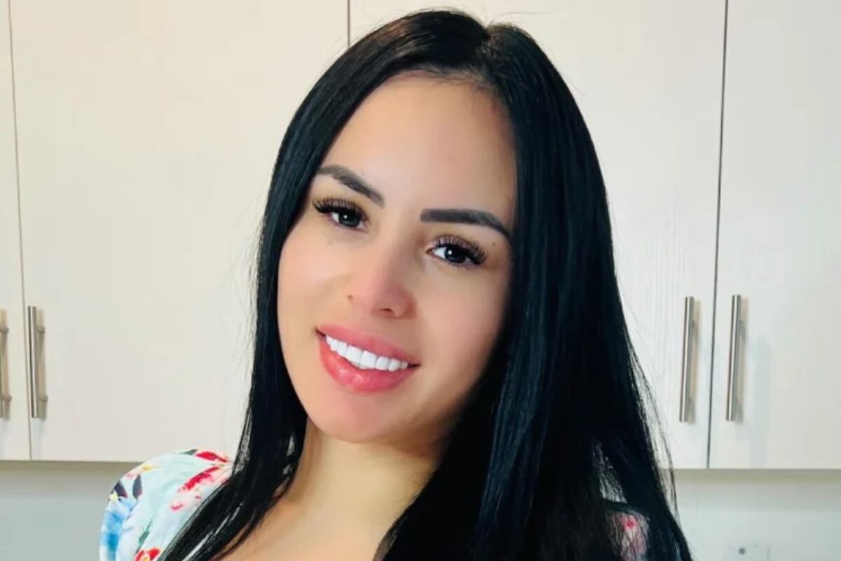 Evelyn Beltrán decidió someterse a un procedimiento estético para quitarse el relleno de los labios (Foto: Evelyn Beltrán/ Instagram)