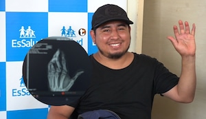 ¡Hazaña médica! Especialistas de hospital Almenara reconstruyen mano a mecánico con exitoso reimplante de dedos