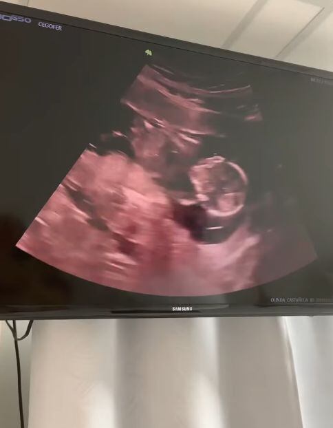 Ecografía de Olinda Castañeda
