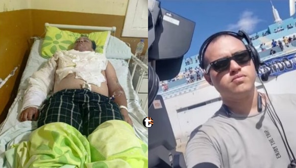 Hombre es quemado por amigo