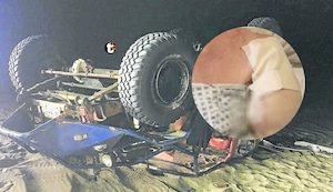 ¡Paseo terminó en tragedia! Turista pierde un brazo tras accidente en Huacachina con tubulares que operan de forma ilegal