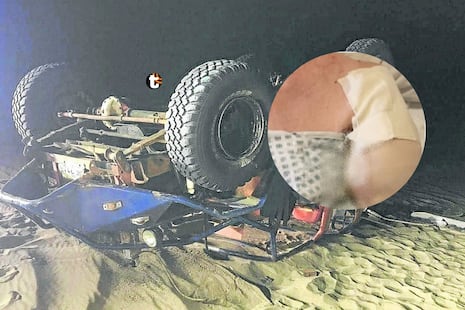 ¡Paseo terminó en tragedia! Turista pierde un brazo tras accidente en Huacachina con tubulares que operan...