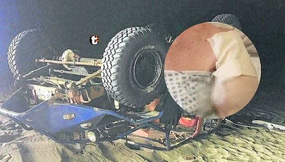 TROME | Turista estadounidense pierde un brazo tras volcadura de tubular en Huacachina. Video: Panamericana