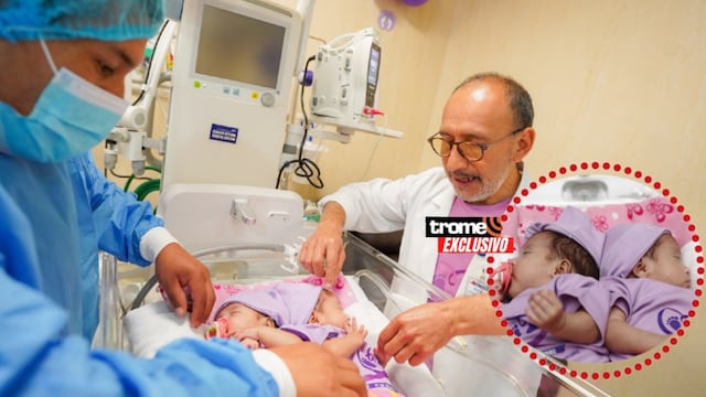El Perú registra alrededor de 30 mil nacimientos prematuros cada año. Estos bebés afrontan graves riesgos, pero pueden recuperarse. Hace unos días nacieron gemelas prematuras siamesas. (INSN-San Borja / Isabel Medina / Trome).