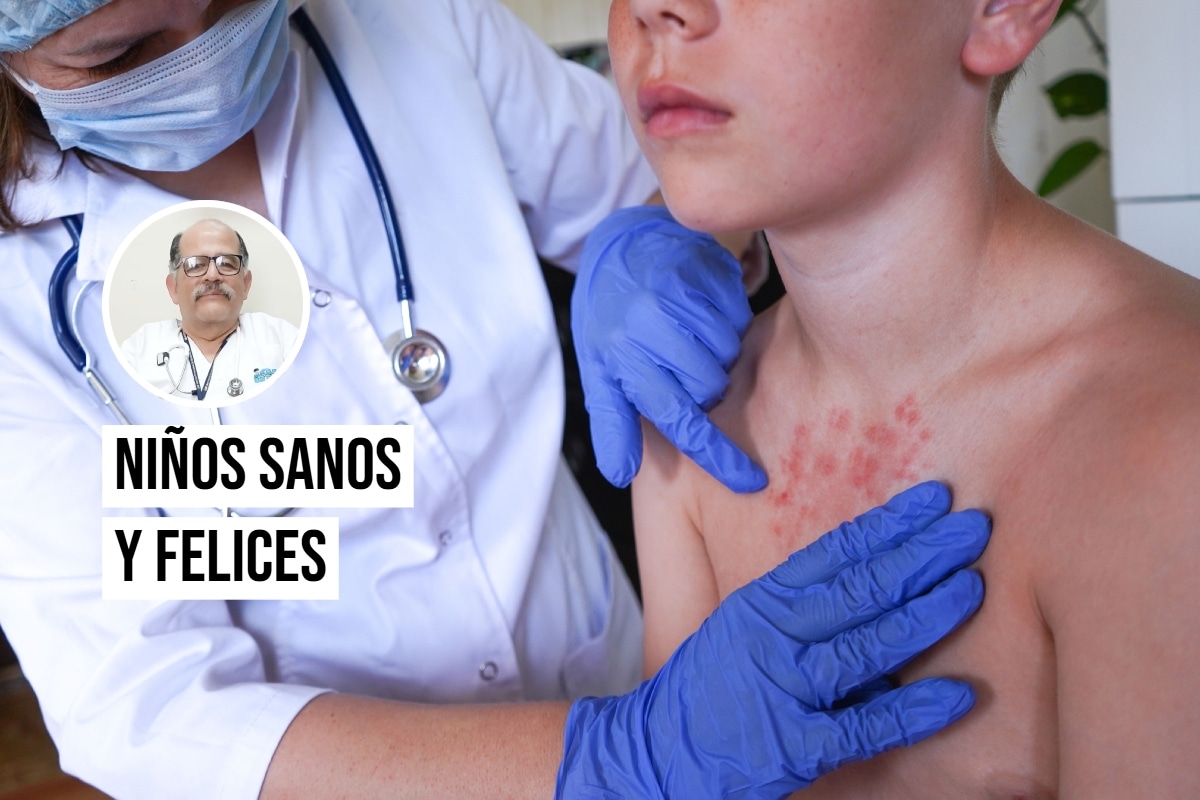 Han aumentado casos de sarampión en el país, advierte el pediatra Carlos Chacón. Foto: Istock.