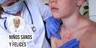 Han aumentado casos de sarampión en el país, advierte el pediatra Carlos Chacón. Foto: Istock.