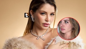 Flavia Laos reflexiona sobre su lucha contra la psoriasis: “No me quita las ganas de seguir creando, soñando y creciendo”