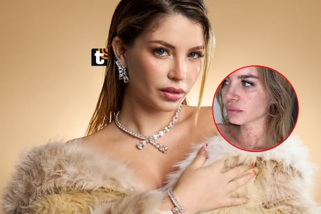 Flavia Laos reflexiona sobre su lucha contra la psoriasis: “No me quita las ganas de seguir creando, soña...