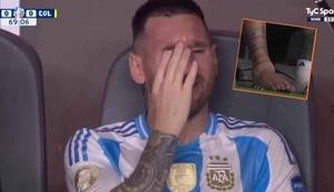 Muestran cómo quedó el tobillo de Lionel Messi, tras lesión que lo obligó a dejar la final de la Copa América