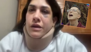 Hermana de Evelyn Vela es agredida por su esposo cantante: “Su cabeza está llena de bolas de golpes” | VIDEO