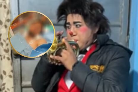 Amigo DJ de ‘payasito Tuki Tuki’ está en UCI tras ataque de sicarios: Tiene un pulmón colapsado