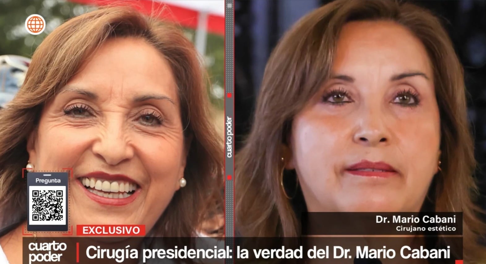 Mario Cabani reveló las cuatro operaciones estéticas a las que se sometió Dina Boluarte.