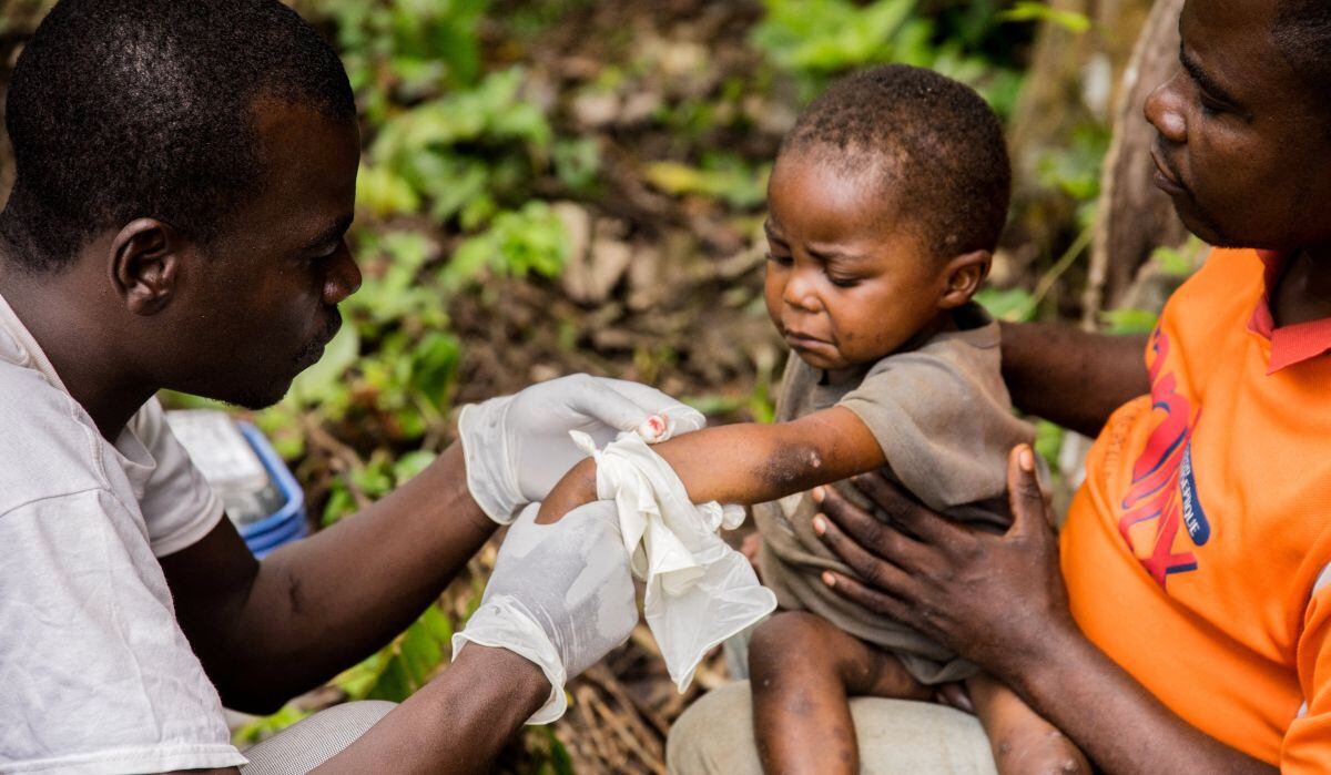 Un niño afectado por la viruela del simio, se sienta en las piernas de su padre mientras recibe tratamiento en el centro de la ONG médica internacional Médicos sin Fronteras (MSF), en Zomea Kaka, en la región de Lobaya, en la República Centroafricana el 18 de octubre de 2018 (Foto: Charles Bouessel / AFP)