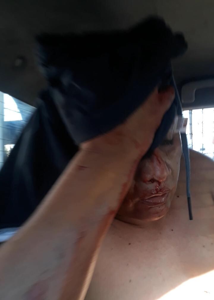 Los fiscalizadores del municipio de el Agustino, Freddy Mendoza (44) y su compañero Walter Carrera, resultaron heridos al ser atacados a fierrazos por un mototaxista que se resistió a un operativo de erradicación de mototaxis informales.