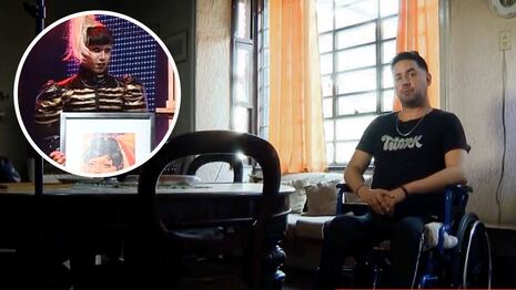 Imitador de Lady Gaga de ‘Yo soy’ vive sin poder caminar tras accidente automovilístico