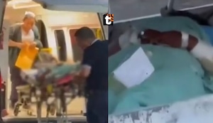 ¡Brutal ataque! Hombre rocía gasolina y quema a su pareja: revelan su diagnóstico