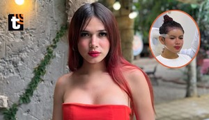 La ‘Uchulú’ se somete a trasplante capilar y sorprende a sus seguidores: “Con la frente en alto”